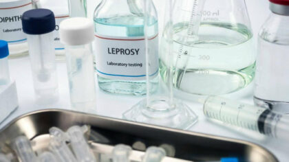 Alerta medicala! Lepra revine in...
